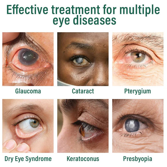 AnnieCareยฎ Nano Eye Drops Serum โ
FDA Approved(Suitable for presbyopia, dry eye syndrome, glaucoma, and cataracts)