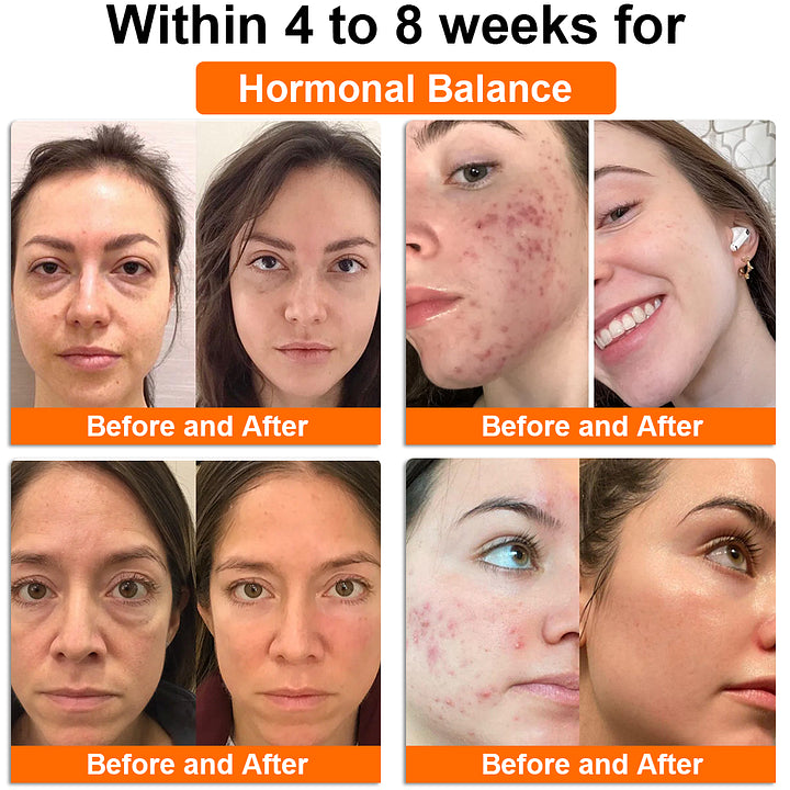 Anniecare® 𝖡𝖾𝖾 𝖵𝖾𝗇𝗈𝗆 𝖭𝖺𝗍𝗎𝗋𝖺𝗅 𝖱𝖾𝗉𝖺𝗂𝗋 𝖵𝖺𝗀𝗂𝗇𝖺𝗅 𝖢𝖺𝗉𝗌𝗎𝗅𝖾𝗌 — 𝖲𝗎𝗉𝗉𝗈𝗋𝗍𝗌 𝖥𝖾𝗆𝖺𝗅𝖾 𝖧𝗈𝗋𝗆𝗈𝗇𝖾 𝖡𝖺𝗅𝖺𝗇𝖼𝖾, 𝗉𝖧 𝖡𝖺𝗅𝖺𝗇𝖼𝖾, 𝖵𝖺𝗀𝗂𝗇𝖺𝗅, 𝖫𝗂𝖻𝗂𝖽𝗈, 𝖬𝖾𝗇𝗈𝗉𝖺𝗎𝗌𝖾 𝖺𝗇𝖽 𝖲𝗄𝗂𝗇 𝗁𝖾𝖺𝗅𝗍𝗁